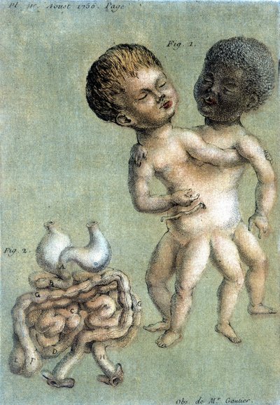 图森（1756 年）在 "Periodic Observations sur la Physique, l