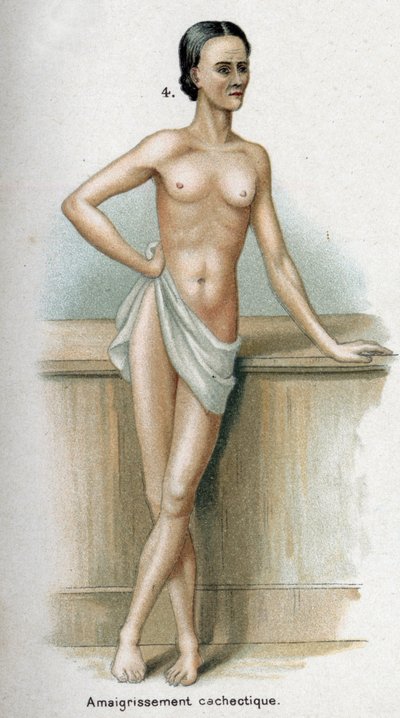 消瘦的女性肖像（印刷品） 作者 法语学校