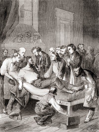 1846 年，美国牙医威廉·托马斯·格林·莫顿 (William Thomas Green Morton) 首次公开展示了使用吸入乙醚作为手术麻醉剂，来自《科学之家》(Les Merveilles de la Science)，出版于 1870 年 作者 法语学校