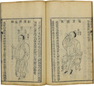 沈士尧汉的《眼科宝鉴》，1644年 作者 傅仁玉
