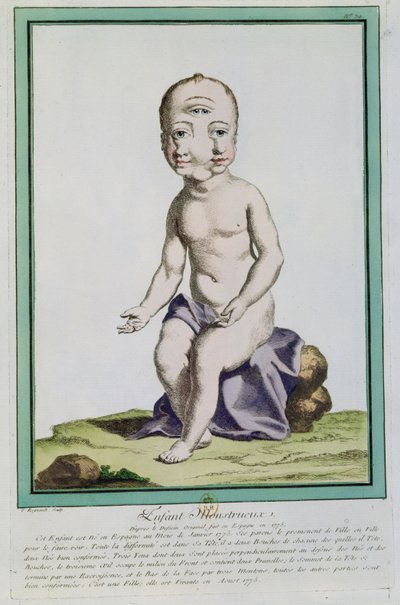 1775年，来自巴黎的&39;Les Ecarts de la Nature&39;的变形头的孩子 作者 Genevieve Regnault de Nangis