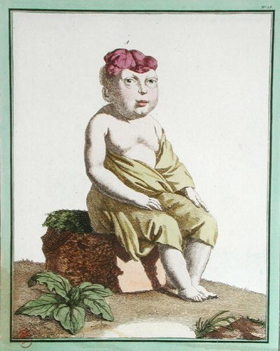 半个头的孩子，来自巴黎的 "Les Ecarts de la Nature"。 作者 Genevieve Regnault de Nangis
