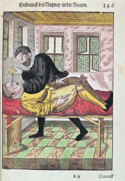 眼科手术，来自Ophthalmodouleia的Georg Bartisch（1535-1636）于1583年在德累斯顿出版（彩色木版画） 作者 德国学校