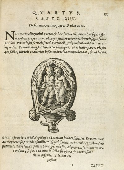 子宫中不同的双胞胎，例如，1587年第11章，关于人类的概念和成长的第4册，1587年 作者 德国学校