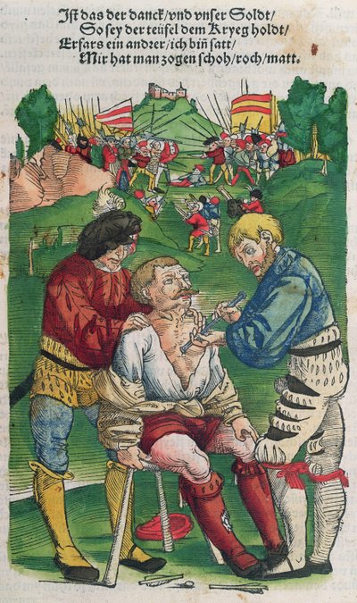 删除箭头，插图来自Feldtbuch der Wundartzney，Hans von Gersdorff，1540 作者 德国学校
