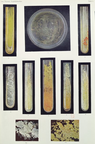梅毒芽孢杆菌，来自Max von Niessen，Leipzig，1908年出版的一本书 作者 德国学校
