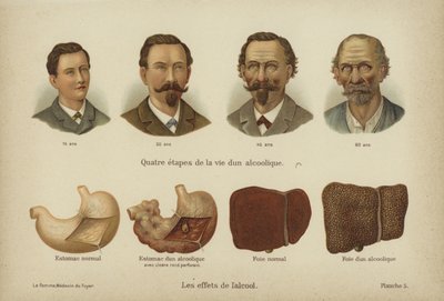 The effects of alcohol abuse (colour litho) 作者 德国学校