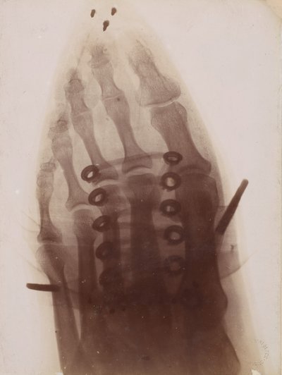穿过鞋子的脚，1896年。 作者 亨利·凡·赫克