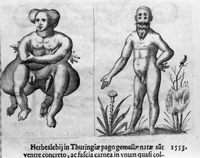 不同类型的人类怪物。 雕刻意大利科学家 Fortunio Liceti（1577-1656）的“怪物性质、原因和差异”。 1646 作者 意大利学校