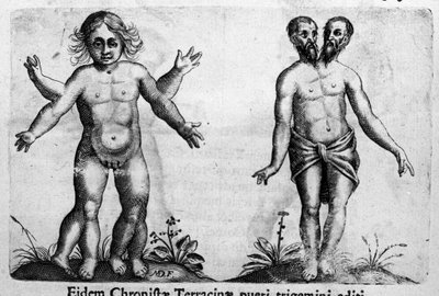 不同类型的人类怪物 由意大利科学家 Fortunio Liceti (1577-1656) 雕刻“怪物的性质、原因和差异”。 1646 作者 意大利学校