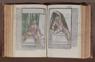 女性解剖，从历史，用最慷慨增加的解剖mundini，发表在博洛尼亚byJacopo Berengarlo DA卡尔皮（c.1460-c.1530），1521（彩色版画） 作者 意大利学校