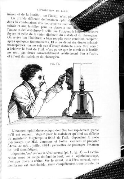 来自 "Traite Pratique des Maladies des Yeux "的插图，这是托马斯-沃顿-琼斯（1808-91）翻译的《眼科医学和外科原理与实践手册》，由E. Foucher翻译，1862年在巴黎出版（雕刻）（b/w照片） 作者 让·弗朗索瓦·巴杜罗