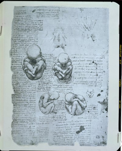 子宫中的五个视图，传真副本 作者 达芬奇（Leonardo da Vinci）