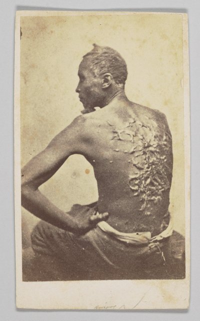 戈登接受医疗检查，1863年。 作者 麦克弗森和奥利弗