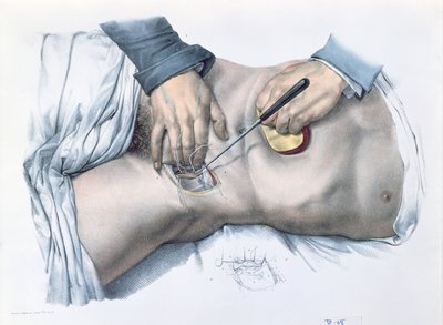绑架动脉，由Jean-Baptiste Marc Bourgery（1797-1849）1866-67从“人类解剖学的完整特征”中盘起 作者 尼古拉斯·亨利·雅各布