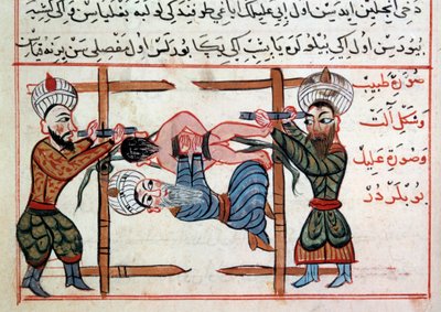 减少骨折。 Sharaf al-din 的土耳其医学疗法的缩影 作者 奥斯曼帝国学校