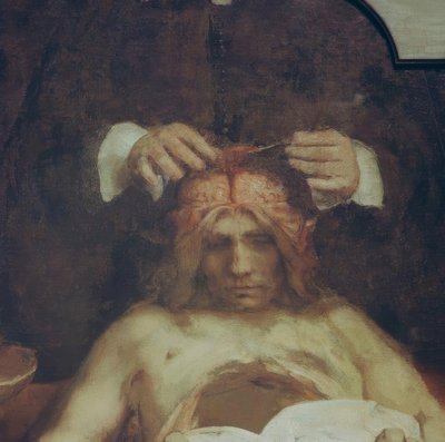 英格博士的解剖。约翰·戴曼（Johan Deijman） 作者 伦勃朗·范·赖恩