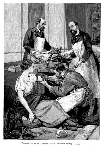 1891年，一名结核病患者接受了山羊血液的输血 作者 不明