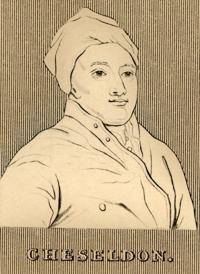 Cheseldon，1688-1752，1830。 作者 不明