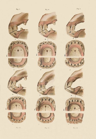 显示牙齿年龄的盘子的描述，如牙齿所示，c1879。 作者 不明