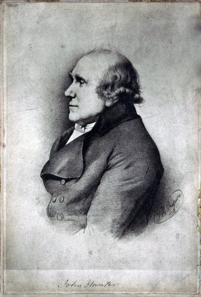 约翰亨特，英国外科医生和解剖学家，1770 年代 作者 不明