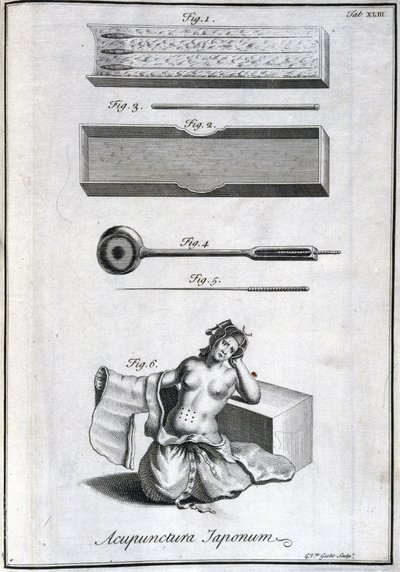 替代医学：planche 代表 les aiguilles d
