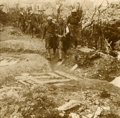 1916年，受伤的法国步兵抵达法国北部凡尔登城堡埃斯纳城堡 作者 不明