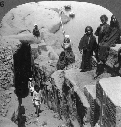 1905年，埃及第一例白内障的淹没度测量仪。 作者 安德伍德和安德伍德