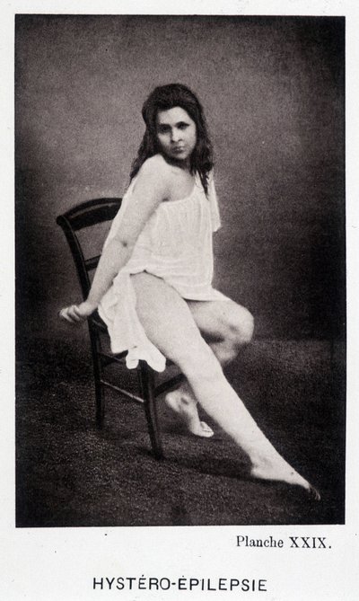 Hystero Epilepsie - “”Salpétrière 的摄影图像中的挛缩：Charcot 先生的服务”，Paul Regnard 和 Bourneville 作者 未知艺术家