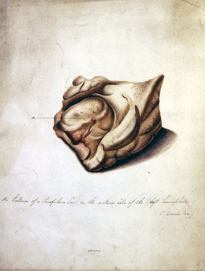 大脑研究II，约1850年（纸上水彩）。 作者 威廉·洛弗
