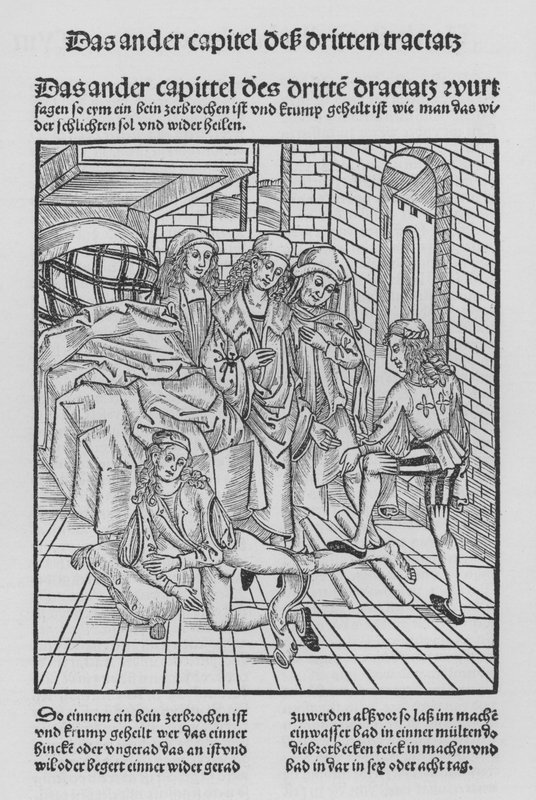 The Book of Cirurgia by Hieronymus Brunschwig (litho) 作者 （之后）德国学校