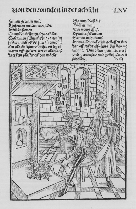 The Book of Cirurgia by Hieronymus Brunschwig (litho) 作者 （之后）德国学校