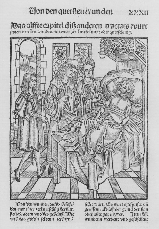 The Book of Cirurgia by Hieronymus Brunschwig (litho) 作者 （之后）德国学校