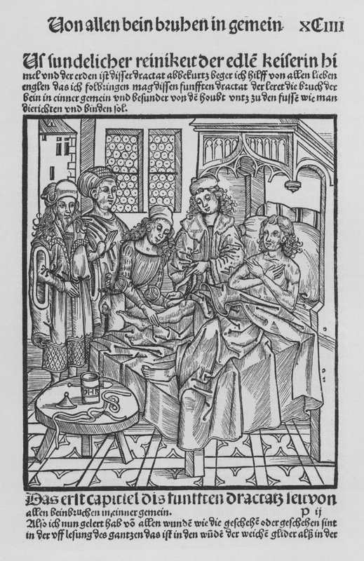 The Book of Cirurgia by Hieronymus Brunschwig (litho) 作者 （之后）德国学校