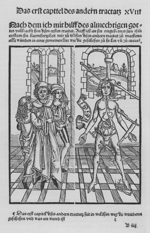 Hieronymus Brunschwig (石版画) 作者 （之后）德国学校