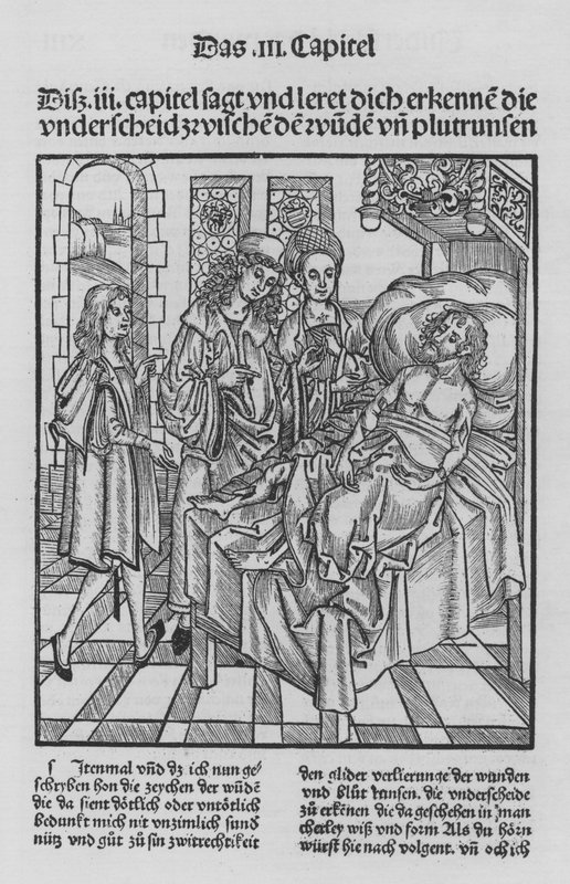 Hieronymus Brunschwig (石版画) 作者 （之后）德国学校