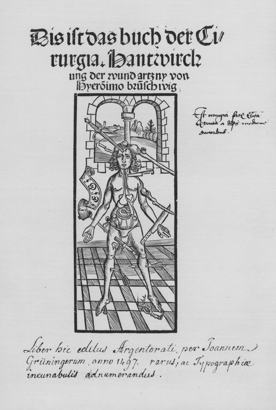 Hieronymus Brunschwig (石版画) 作者 （之后）德国学校