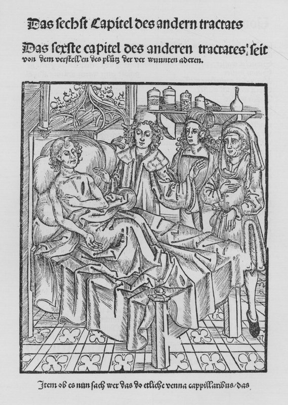 Hieronymus Brunschwig (石版画) 作者 （之后）德国学校