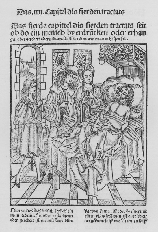 The Book of Cirurgia by Hieronymus Brunschwig (litho) 作者 （之后）德国学校