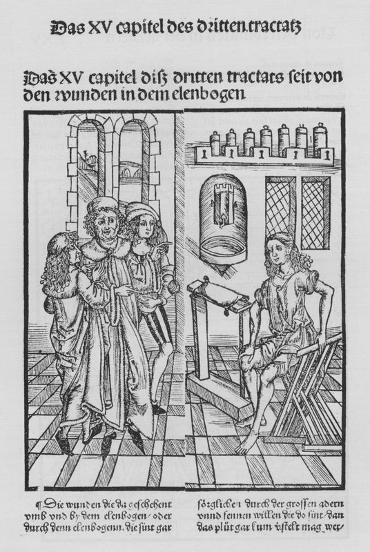 The Book of Cirurgia by Hieronymus Brunschwig (litho) 作者 （之后）德国学校