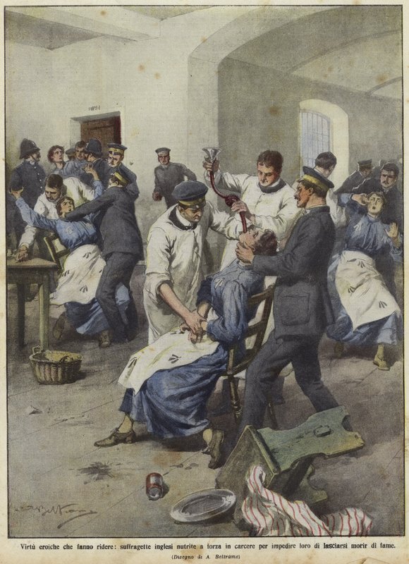 英国女权主义者在监狱中被强制喂养 作者 阿基里·贝尔特拉姆（Achille Beltrame）