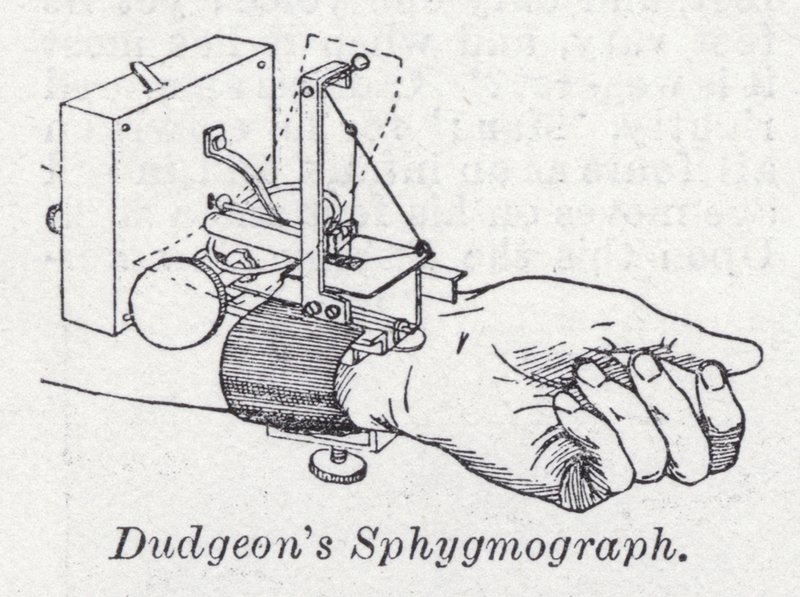 Dudgeon 的血压计（石版印刷） 作者 英语学校