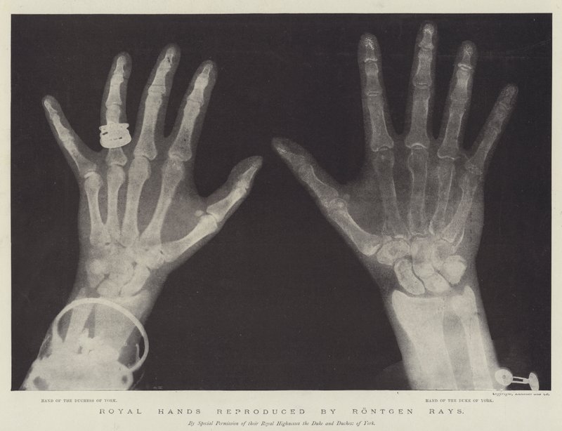 Royal Hands reproduced by Rontgen Rays (engraving) 作者 英语学校
